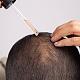 HairTranspl